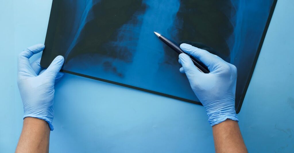 A doctor in blue gloves examines a chest x-ray with a pen, focusing on medical diagnosis.